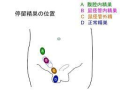 小児の泌尿器科疾患についての質問 いまもと泌尿器科クリニック